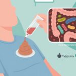Fecal Microbiota Transplantation versus Vancomycin in Primary Clostridioides difficile Infection: A Noninferiority Randomized Trial