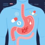 GLP-1 Receptor Agonists and Risk of GERD in Type 2 Diabetes: Clinical Implications from a Large Population-Based Cohort Study