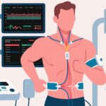 Tăng cường khả năng tập luyện thông qua kích thích thần kinh phế vị không xâm lấn: Bằng chứng từ một thử nghiệm ngẫu nhiên có kiểm soát
