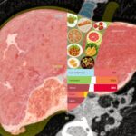 断続的カロリーリストリクション：メタボリック機能不全関連脂肪性肝疾患の有望な食事戦略