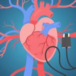Understanding and Managing Hypertension: A Comprehensive Guide