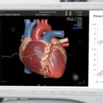 Impact of Structural Cardiac Abnormalities on the Efficacy and Safety of Sacubitril/Valsartan in Patients with Mildly Reduced or Preserved Ejection Fraction and Worsening Heart Failure: Insights from the PARAGLIDE-HF Trial
