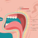 Long-Term Outcomes of Transoral Surgery with Risk-Adapted Adjuvant Therapy in HPV-Positive Oropharyngeal Cancer: Results from the E3311 Trial