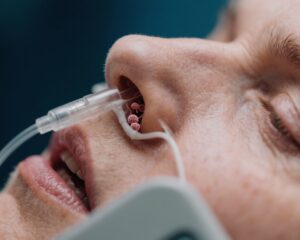 Mupirocin Nasal Ointment Significantly Reduces Severe Acute Radiation Oral Mucositis in Nasopharyngeal Cancer Patients: Insights from a Phase 3 Trial