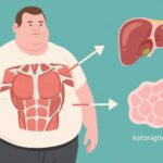 Three Weeks of Ketogenic Diet Significantly Boosts Skeletal Muscle Insulin Sensitivity in Obesity: Insights from a Randomized Crossover Trial