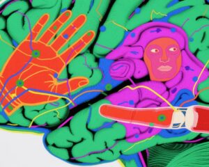 切断された肢の痛みがなぜ持続するのか？新しい脳画像研究が重要な洞察を提供