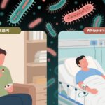 Oral Regimens for Whipple’s Disease: A Non-Inferiority Trial of Doxycycline-Hydroxychloroquine Versus Standard Intravenous Therapy
