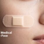The Truth About Acne Patches: Benefits, Risks, and Expert Insights