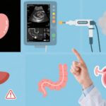 Six Early Warning Signs Your Body May Be Sending: Precancerous Conditions to Notice and Act On