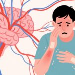 5 hành động giúp bạn phòng ngừa các dấu hiệu của nhồi máu não…