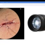 Revolutionizing Wound Healing Assessment: The Role of LC-OCT and AI
