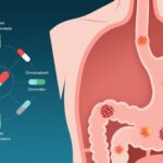 LEAP-015: Evaluating Lenvatinib Plus Pembrolizumab and Chemotherapy Versus Chemotherapy Alone in Advanced Gastroesophageal Adenocarcinoma