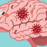 预防疱疹能否降低痴呆风险？新科学发现将唇疱疹、带状疱疹和阿尔茨海默病联系起来