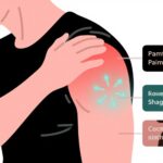 Three Diseases to Watch for When Experiencing Shoulder Pain: Don’t Mistake These Pain Locations for Frozen Shoulder