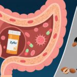 New insights into food allergy mechanisms—DPEP1, leukotrienes, and the potential of Zileuton
