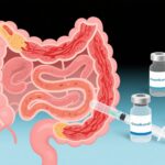 グセルクマブによるクローン病と潰瘍性大腸炎の治療：最近の第3相試験における有効性と安全性