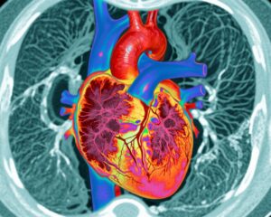 Myocardial T1 Mapping and Extracellular Volume: Emerging Prognostic Tools in Heart Failure and Non-Ischaemic Dilated Cardiomyopathy