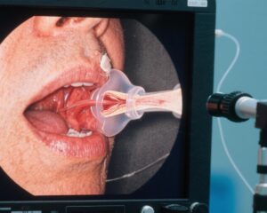 Oral Corticosteroids Fail to Improve Recovery in Vocal Fold Paralysis After Thyroid Surgery: Insights from a Randomized Clinical Trial