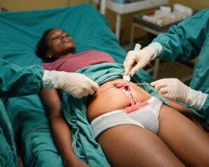 Open Anterior Mesh Repair Versus Modified Technique for Groin Hernia in Women: Insights from a Ugandan Randomized Trial