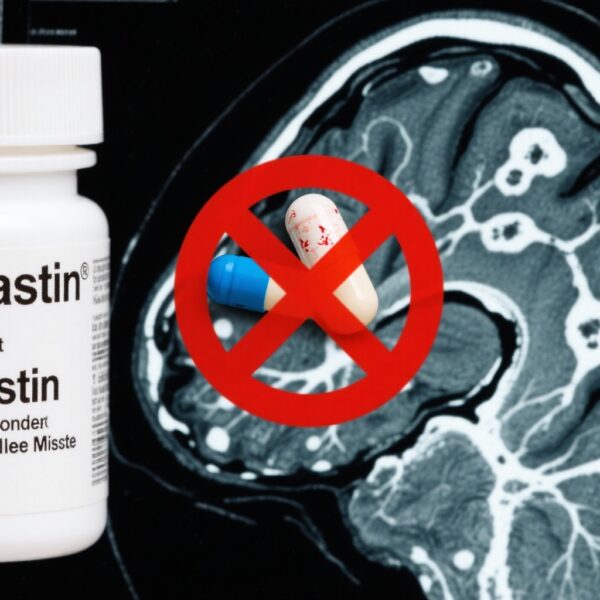 Alzheimer’s Disease: Navigating Controversies and Shaping Future Strategies