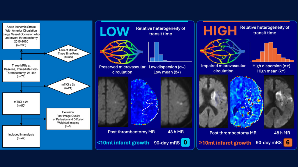 Microvascular Dysfunction After Reperfusion Predicts Stroke Infarct Expansion and Poor Outcomes